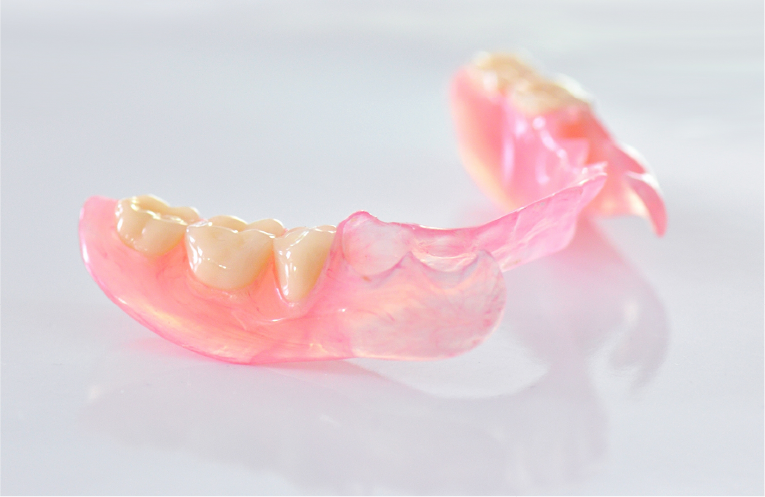 ノンクラスプデンチャー